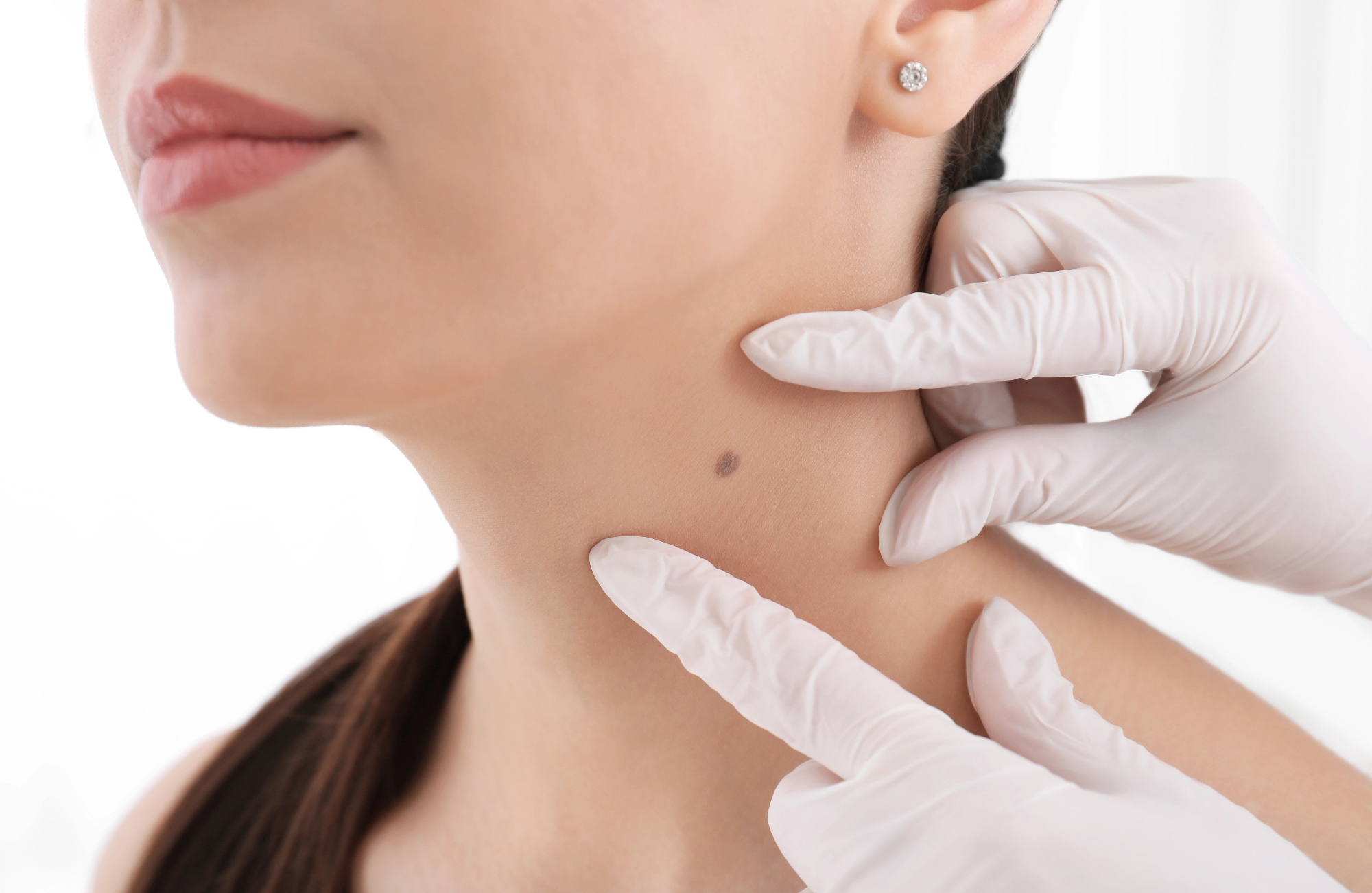 Zdravo in lepo kožo nam omogoča dermatologija, ki je veja medicine, ki obravnava kožo